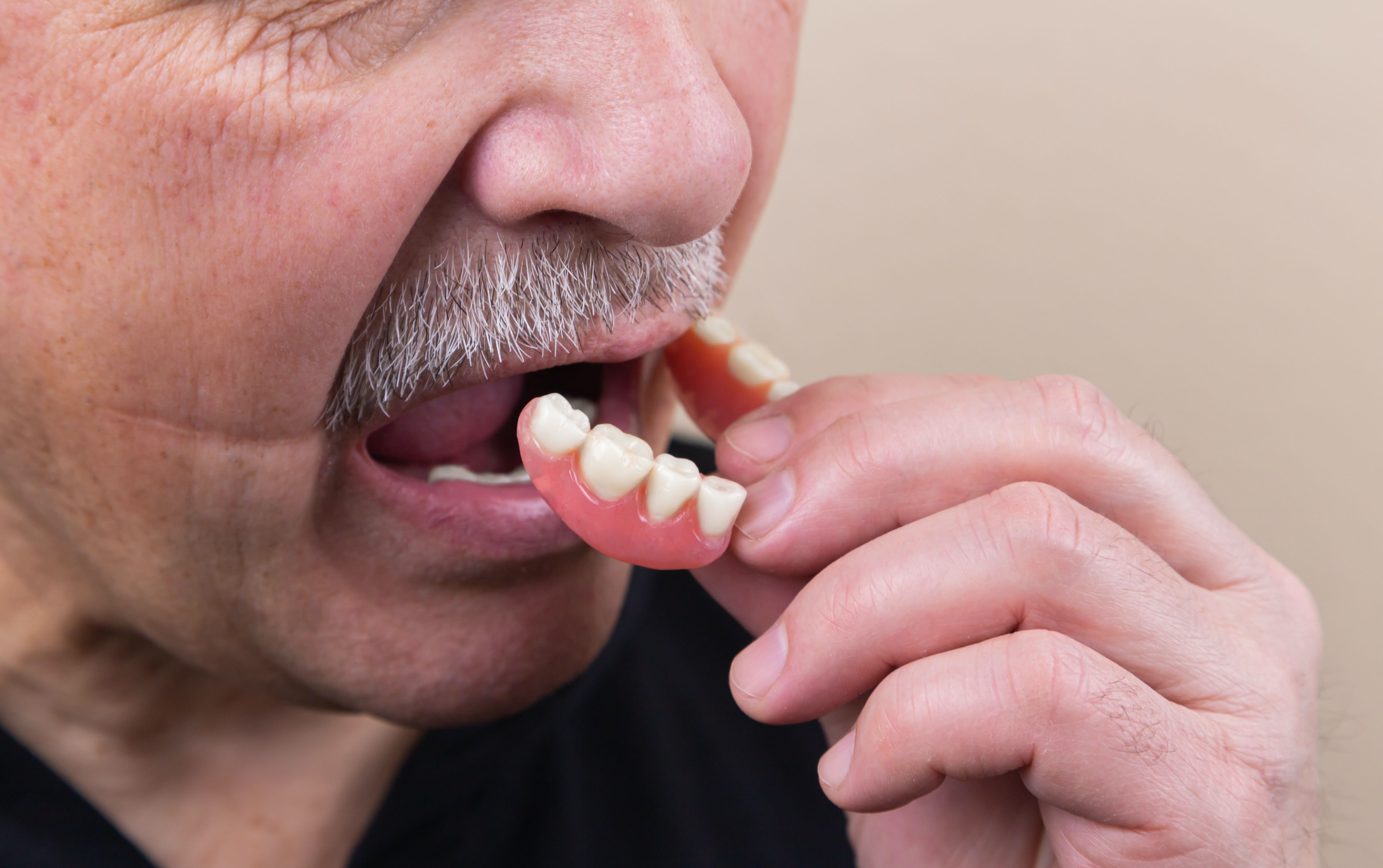 What are some different types of dentures