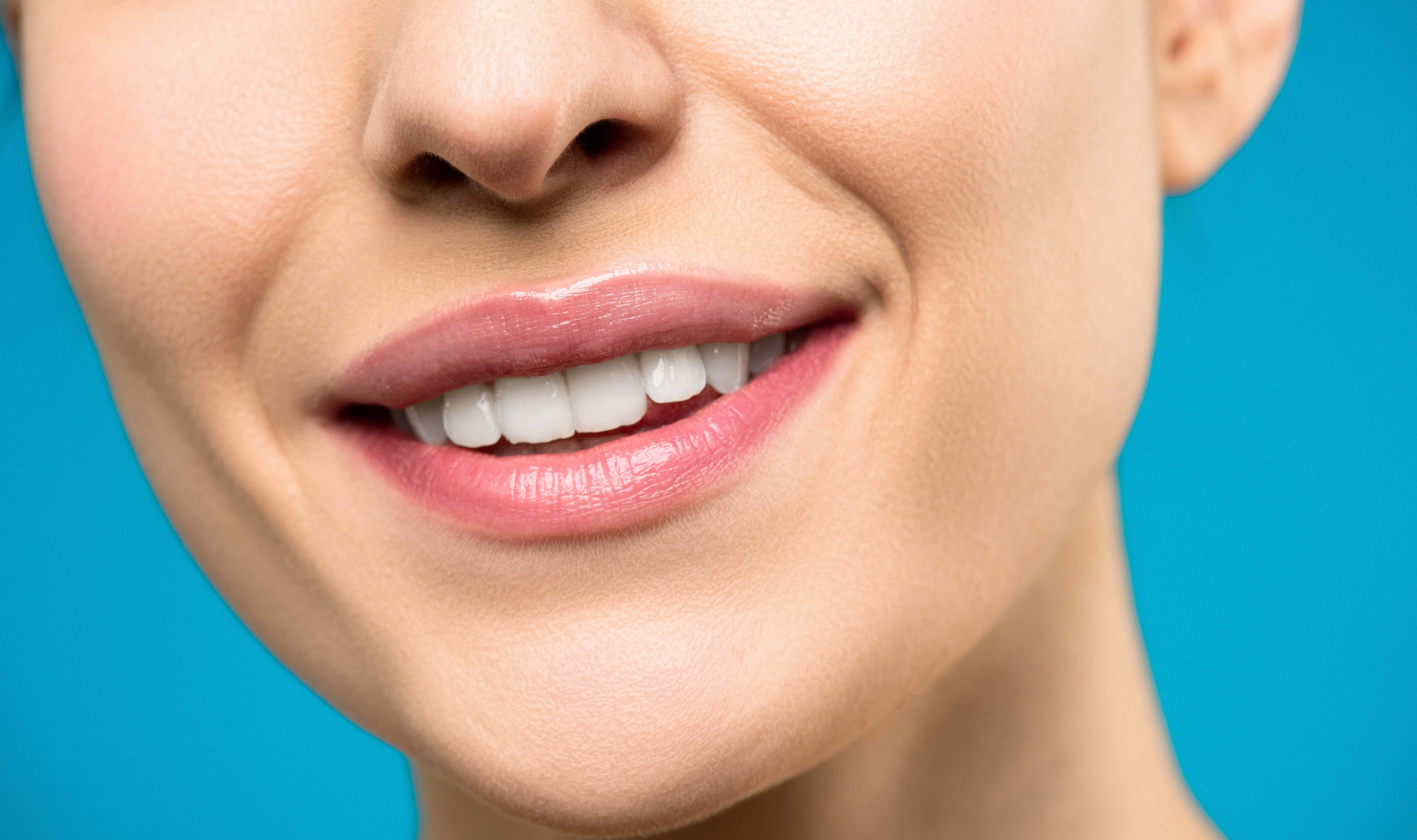 Tooth Whitening 101: iSmile Dental’s Guide for Brighter Smiles in Langley