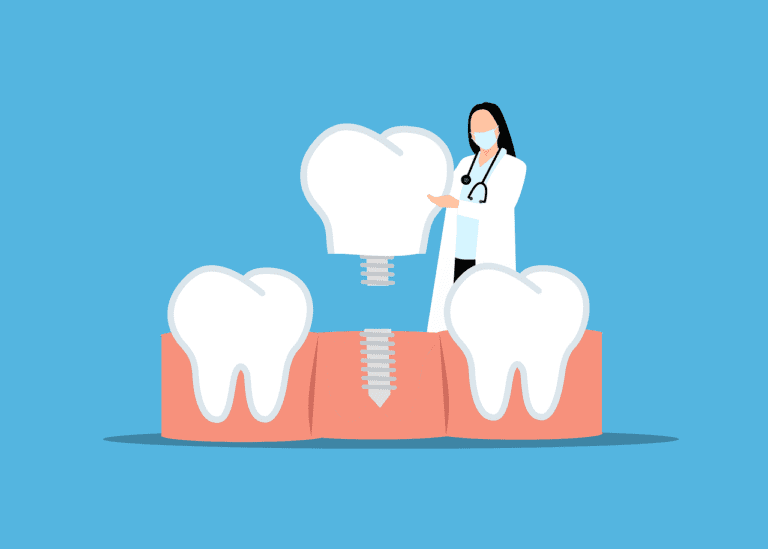 Why Replacing Missing Teeth is Crucial for Your Oral Health and Overall Well-being | iSmile Dental Langley