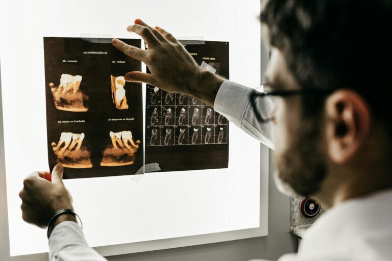 Are Dental X-Rays Safe? A Langley Dentist Explains